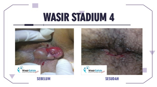 update-gangguan-umum-1