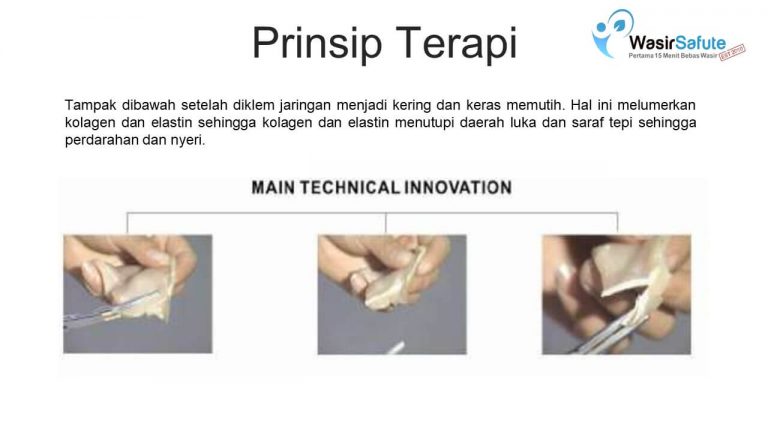 img-slide-presentation-update-artikel-wasir (15)