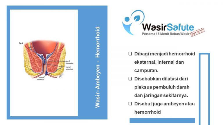 img-slide-presentation-update-artikel-wasir (2)
